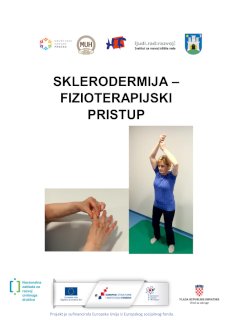 SKLERODERMIJA FIZIOTERAPIJSKI PRISTUP